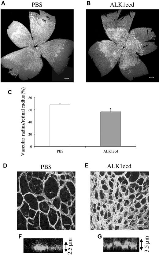 Figure 3. ALK1ecd treatment in Bmp9-KO mice increases vascularization of the retina. (A-B) Visualization of blood vessels by isolectin B4 (iB4) staining of retinas at P5 from Bmp9-KO mice treated or not with ALK1ecd (5 mg/kg) injected at P1 and P3. (C) Bar graphs show the relative distance covered by the vascular plexus calculated as the ratio of the vascular radius over the retinal radius in percentage. (D-E) Higher magnifications of the retinas show that ALK1ecd treatment in Bmp9-KO mice lead to larger and multilayered blood vessels (see also z scan in panels F and G). Panels A through G show data from 2 litters containing 8 PBS treated Bmp9-KO mice and 7 ALK1ecd treated Bmp9-KO mice. Error bars show SEM. (A-B) Scale bar = 200 μm. (D-E) Scale bar = 25 μm.