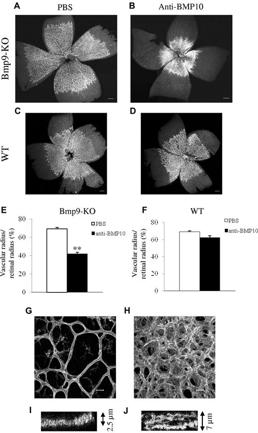 Figure 5. Anti-BMP10 treatment disrupts vascularization of the retina of Bmp9-KO mice. Visualization of blood vessels by isolectin B4 (iB4) staining of retinas at P5 from Bmp9-KO (A-B) or WT (C-D) mice treated with PBS or anti-BMP10 antibody (15 mg/kg) injected at P1 and P3. (E-F) Bar graphs show the relative distance covered by the vascular plexus calculated as the ratio of the vascular radius over the retinal radius in percentage in Bmp9-KO mice (E) and in WT mice (F). (G-H) Higher magnifications of the retinas show that anti-BMP10 treatment in Bmp9-KO mice lead to larger and multilayered blood vessels (see also z scan in panels I and J). Panels A, B, E, G, H, I, and J show data from 4 litters containing 12 PBS-treated Bmp9-KO pups and 7 anti-BMP10 treated pups. Panels C, D, and F show data from 2 litters containing 6 PBS treated WT pups and 6 anti-BMP10 treated pups. Error bars show SEM. **P < .01 versus PBS group. (A-D) Scale bar = 200 μm. (G-H) Scale bar = 20 μm.
