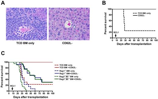 Figure 1. CD62L− T cells enhance the ability of TCD BM recipients to prevent tumor growth. T cell–depleted bone marrow cells (1 × 107) from B6 CD45.2 (A-C) or Rag1−/− or Rag2−/−γC−/− (C) mice and CD62L− T cells (1 × 106) from unprimed B6 CD45.1 mice were first transplanted into lethally irradiated BALB/c recipients. The recipient mice were then challenged with 5 × 105 host-type BCL1 tumor cells at day 7 after transplantation. The recipient mice were monitored for development of leukemia or lymphoma and survival. Each group contained 8 to 20 mice. The data are pooled from 2 independent experiments. (A) Histologic analysis of liver (H&E stain, ×100). Tissue from TCD BM only group was obtained on day 28; tissue from CD62L− T-cell recipients was obtained on day 166. (B) Survival (P < .001). (C) Survival: TCD BM only versus Rag1−/− BM only or Rag2−/−γC−/− BM only (P < .05); BM only groups versus their corresponding CD62L− groups (P < .01); TCD BM + CD62L− versus Rag1−/− BM + CD62L− or Rag2−/−γC−/− BM + CD62L− (P < .0001).