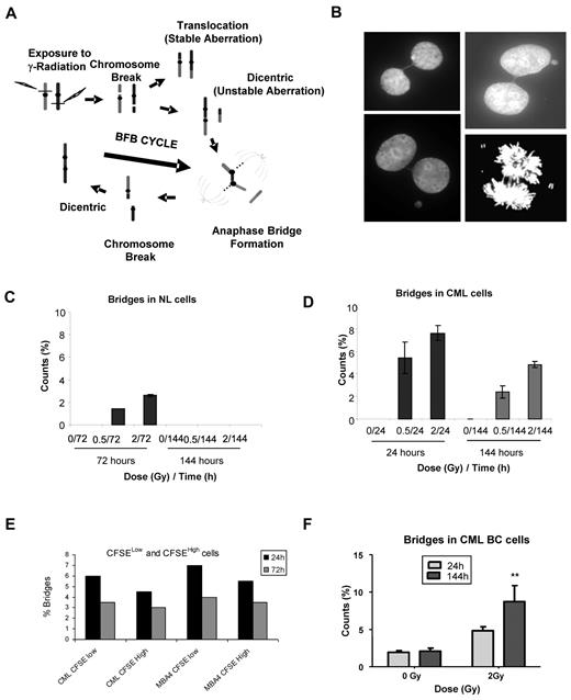 Figure 4. Nucleoplasmic bridges in normal and CML CD34+ cells after radiation exposure. (A) The sequence of events leading to BFB formation after exposure of cells to radiation. DNA DSBs resulting from radiation exposure on repair may result in formation of a dicentric chromosome. The 2 centromeres in the dicentric chromosome will attach to opposite poles during cell division, leading to bridge formation and subsequent tearing of the chromosome. The broken end of the chromosome may fuse with another broken chromosome, leading to formation of another dicentric initiating another BFB cycle. (B) Representative images of nucleoplasmic bridges (original magnification ×630). Formation of nucleoplasmic bridges at 24 hours (1 cell division) and 72 hours (3 or 4 cell divisions) after exposure to radiation in (C) normal CD34+ cells (n = 3) and (D) CML CD34+ cells (n = 3). Results represent mean ± SEM of multiple experiments. (E) Nucleoplasmic bridges at 24 hours (1 cell division) and 144 hours (6 or 7 cell divisions) in CML BC CD34+ cells (n = 6) with and without exposure to radiation. (F) Formation of nucleoplasmic bridges in CFSElow and CFSEhigh cell populations from CML CP CD34+ cells and MBA-4 cells after exposure to radiation. No significant difference in bridge formation was observed between these 2 populations in both cell types.