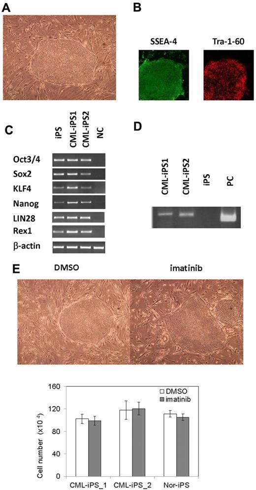 Figure 2. Generation of CML derived iPSCs. (A) Morphology of CML-iPSCs. (B) Immunofluirescence staining shows expression of pluripotent marker (left: SSEA-4 and right: Tra-1-60) in CML-iPSCs. (C) RT-PCR analysis of ES cell marker genes. Endogenous expression of these stem cell–specific genes in CML-iPSCs was verified. (D) CML-iPSCs expressed the BCR-ABL fusion transcript. (E) Imatinib (10μM) were added to the culture of iPSCs. DMSO (top left panel) and imatinib (top right panel) treated CML-iPSCs were shown. The number of alive CML-iPSCs (CML-iPS_1 and CML-iPS_2) and normal iPSCs (Nor-iPS) after 5 days treatment was calculated (bottom panel). These were the representative data from 3 independent experiments.