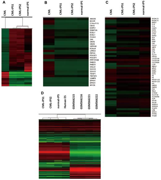 Figure 3. Comprehensive analysis of DNA methylation and gene expression. (A) Unsupervised hierarchical clustering based on differentially methylated CpGs is shown on the dendrogram. The accompanying heatmap shows the methylation status across 5001 differentially methylated CpGs. In the heatmap, red indicates a CpG methylation more than 50%, and green less than 50%. The methylation status in hypo SS DMRs (B) or hyper SS DMRs (C) was shown in the heatmap. (D) Unsupervised hierarchical clustering based on global gene expression data are shown on the dendrogram. The accompanying heatmap shows the normalized log2 transformed expression values (Z-scores) for each probe. In the heatmap, red indicates expression more than mean, and green less than mean.