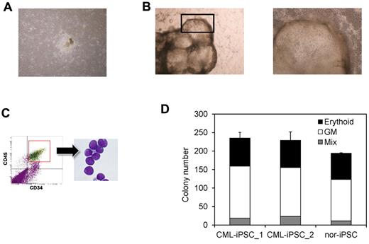 Figure 4. Hematopoietic differentiation of CML-iPSCs. CML-iPSCs were differentiated on the 10T1/2 cells. On day 7 (A), iPSCs began to mount. On day 14 of culture (B: left panel), inflated sac-like structures appeared. These sac-like structures contained the round hematopoietic cells (B: right panel: higher magnification). (C) These hematopoietic cells expressed immature marker CD34 and CD45. (D) CFC activity was estimated using 1 × 104 3CD34+ CD45+cells. Erythroid colonies (black bars), granulocyte-monocyte (GM) colonies (white bars), and mixed GM colonies with erythtoid cells (mix; gray bars) were plotted.