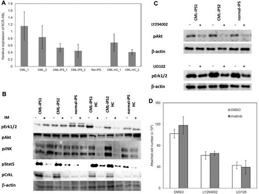 Figure 6. The mechanism of imatinib resistance in the CML-iPSCs. (A) The expression profile of BCR-ABL transcript during hematopoietic differentiation. The expression levels of BCR-ABL in the CML-iPSCs were compared with those of primary CML samples (CML_1 and CML_2), CML-iPSC–derived CD34+ hematopoietic cells (CML-HC_1 and CML-HC_2), and normal iPSC (nor-iPS). The expression level of the mean in the primary CML sample was set at 1. (B) BCR-ABL signaling was estimated in the CML-iPSCs after imatinib (IM) treatment. The phosphorylation state of ERK1/2, AKT, JNK, and STAT5, which are the essential for the survival of BCR-ABL (+) hematopoietic progenitors (CD34+CD45+), were evaluated after imatinib treatment in CML-iPSCs. These were the representative data from 3 independent experiments. (C-D) LY294002 and U0126 (10μM) were added to the culture of CML iPSCs to inhibit AKT and ERK, respectively with or without imatinib. (C) After 4 hours of culture, each inhibitor decreased the phosphorylation of ERK or AKT as expected. (D) The attached cell numbers after treatment with specific AKT or ERK inhibitor were shown. These were the representative data from 3 independent experiments.