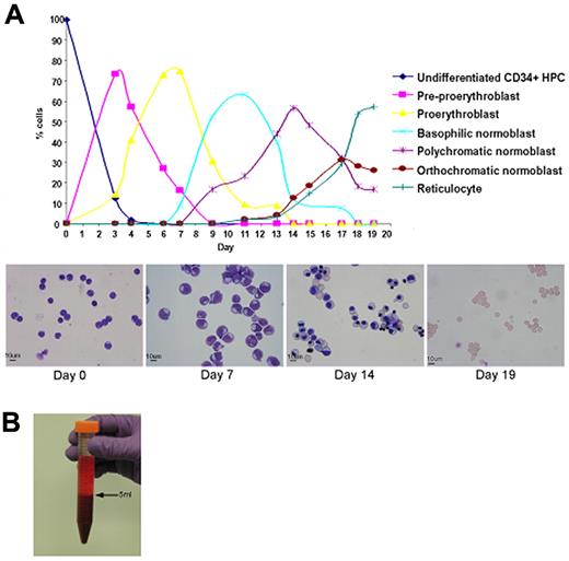 Figure 1. Maturation, proliferation, and enucleation of CD34+ cells from adult peripheral blood. (A) Differential counts and cytomicrographs show the morphology of the cells at different stages in 2 representative cultures using protocol B. (B) Packed pellet of filtered reticulocytes.