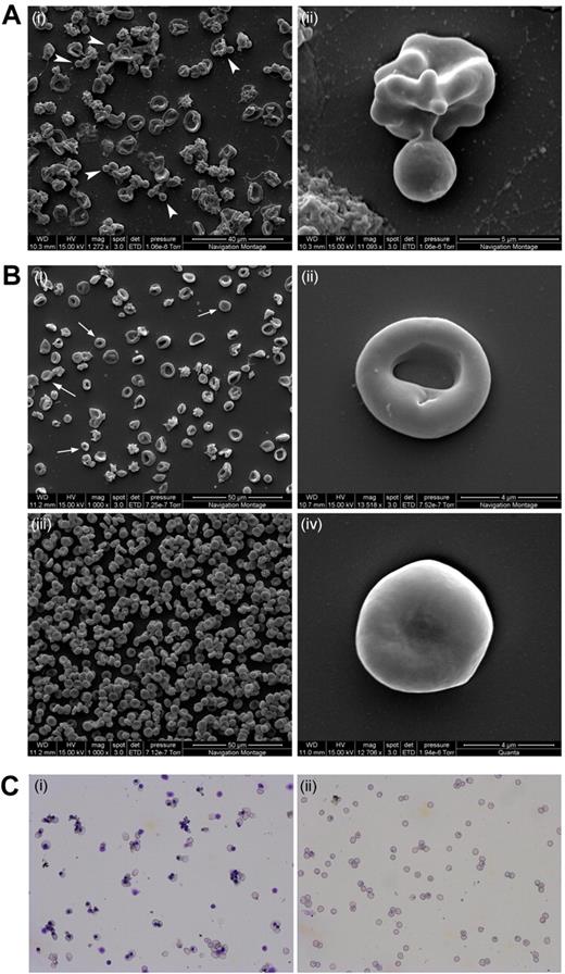 Figure 2. Scanning EM and cytospins of nascent reticulocytes before and after filtration. All cells had been cultured following protocol A. (A) Scanning electron microscopy image of day 18 reticulocytes pre-filtration. The arrowheads indicate free nuclei and/or enucleating cells (i). The panel on the right shows an enucleating reticulocyte (ii). (B) Scanning electron microscopy images of leukocyte filtered reticulocytes (i,ii,iv) and adult peripheral blood (iii). Arrows indicate some of the more mature reticulocytes. Panels ii and iv depict an R2 reticulocyte and an almost mature RBC, respectively. (C) Cytospin image of unfiltered (i) and leukocyte-filtered (ii) day 20 reticulocytes. Scale bar indicates 20 μm.