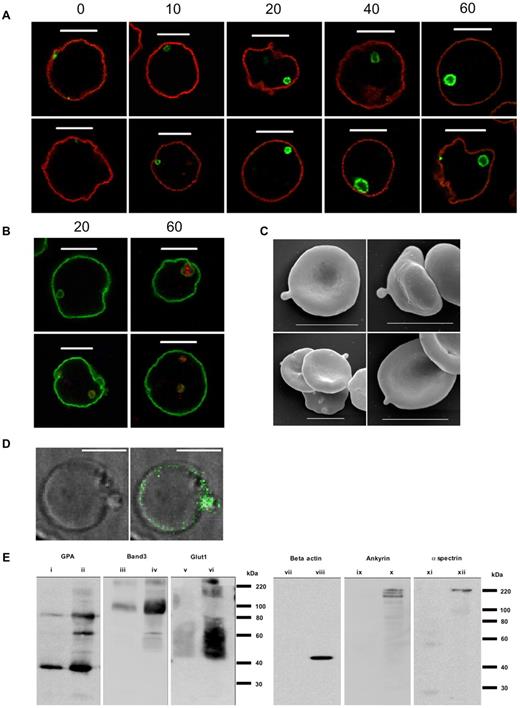 Figure 6. Endocytosis and exocytosis of GPA-positive vesicles in maturing reticulocytes. (A) Unfiltered reticulocytes cultured using protocol B were labeled with BRIC256 at 10°C, followed by incubation at 37°C for 0, 10, 20, 40, and 60 minutes. Incubation with rabbit anti–mouse Fab before permeabilization ensured that any external GPA stained red (Alexa Fluor 546) and internal GPA stained green (Alexa Fluor 488). (B) After a BRIC256 (green) internalization assay for 20 and 60 minutes, reticulocytes were dual stained with anti-LC-3 (red). Scale bars indicate 5 μm. (C) Scanning electron microscopy of filtered reticulocytes showing membrane blebs. Scale bars indicate 5 μm. (D) Live-cell imaging of a reticulocyte showing membrane blebbing (left: phase contrast; right: labeled with anti–GPA-FITC). Scale bars indicate 5 μm. (E) Immunoblot of vesicles purified from filtered reticulocytes (i, iii, v, vii, ix, and xi) and from membranes made from these reticulocytes (ii,iv,vi,viii,x,xii) using rabbit anti-glycophorin A (i-ii), mouse monoclonal anti–band 3 (BRIC170; iii-iv), rabbit anti-GLUT1 (v-vi), mouse monoclonal anti–β actin (clone AC-15; vii-viii), rabbit anti-ankyrin (with cross-reactivity for both α and β spectrin; ix-x), and mouse monoclonal anti α spectrin (BRIC174; xi-xii).