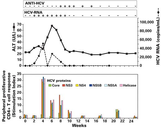 Figure 3. Results of transmission experiment I in chimp X355. Fifty milliliters of plasma from each of 5 donors in the pre–ramp-up phase of HCV infection were infused in a single experimental procedure into chimp X355 (see Figure 1, experiment I) and infectivity monitored by weekly or biweekly measurement of ALT level (solid line), HCV RNA (dashed line and box), anti-HCV (box), and cell-mediated immune response (bottom panel). Transient HCV infection is demonstrated. Note that HCV RNA was no longer detectable by week 10 and that Ab to HCV disappeared by week 18 after infusion. Cell-mediated immune responses, measured in a proliferation assay, peaked at week 4 and considerably diminished by week 10.