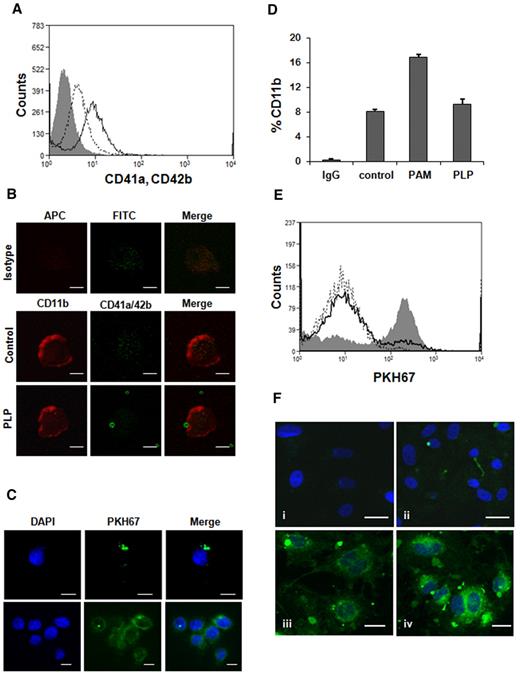 Figure 1. PLPs coincubation with HUVECs and THP-1 cells. (A) THP-1 cells, treated with 1 μg/mL Pam3CSK4, were coincubated with PLPs for 24 hours and stained with CD41a-FITC, CD42b-FITC (open curve; solid line) for flow cytometry analysis. Isotype IgG (gray filled curve), control (no PLPs; open curve, dotted line). (B) The same experiment was carried out staining THP-1 cells for CD11b-APC, CD41a-FITC, and CD42b-FITC. Samples were then mounted on coverslips for confocal microscopy (PLP). IgG control (isotype) and THP-1 alone (control). Scale bar denotes 10 μm; 100× objective lens. (C) Confocal microscopy also was performed on PKH67-labeled PLPs (green fluorescence) cocultured for 24 hours with THP-1 cells to demonstrate PLP internalization. Blue nuclear staining was performed with 4,6-diamidino-2-phenylindole (DAPI). Scale bar denotes 10 μm; 60× objective. (D) The experiment was performed as described in panel A using CD11b-FITC. Untreated cells (control), activated cells (PAM), PLP (THP-1 cells cocultured with PLPs). (E) HUVECs were treated for 10 minutes with 0.5 U/mL thrombin and then coincubated with PKH67-labeled PLPs for 30 minutes (gray filled curve) and analyzed by flow cytometry. Control (open curve, dotted line), untreated HUVEC + PLPs (open curve, solid line). (F) Confocal microscopy of the experiment described in panel E with additional DAPI staining. HUVECs incubated with PKH67-labeled PLPs (ii-iv) and unlabeled PLPs (i). Scale bar denotes 20 μm; 40× objective.