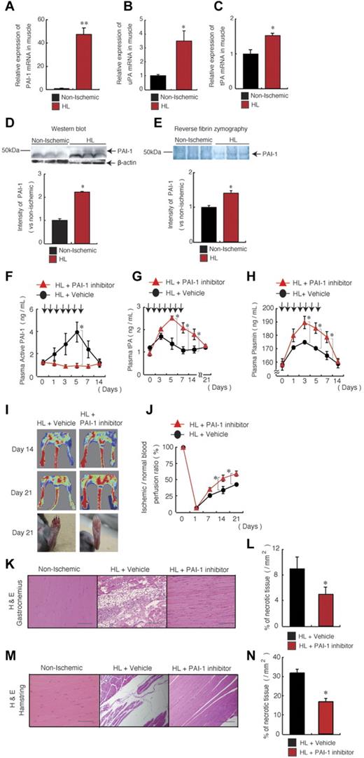 Figure 1. PAI-1 inhibition improves HL-ischemic tissue regeneration. (A-E) C57BL/6 mice were HL treated and gastrocnemius muscles were analyzed on day 1. (A-C) Quantitative RT-PCR analysis of the mRNA expression of PAI-1 (A), uPA (B), and tPA (C) in nonischemic and HL-ischemic muscle tissue using β-actin as an internal control (n = 3/group for all experiments). (D-E) Homogenates of ischemic and nonischemic tissues that were harvested on day 1 after HL-ischemia induction in 3 different C57BL/6 mice were assayed for murine PAI-1 protein by Western blot analysis (D) or for PAI activity by reverse fibrin zymography (E). Densitometric analysis is shown (bottom). (F-N) HL ischemia was induced in C57BL/6 mice, followed by oral administration of the PAI-1 inhibitor or vehicle given daily from days 0-6. Arrows indicate when the PAI inhibitor was administered. Plasma levels of active PAI-1 (F), tPA (G), and plasmin (H) were assayed in PAI-1– or vehicle-treated HL-ischemic mice by ELISA (n = 7/group for PAI-1 and tPA; n = 6/group for plasmin). (I-J) Representative macroscopic images (I) and the limb perfusion ratio (ischemic/nonischemic; J) of ischemic limbs after HL-ischemia induction. Macroscopic evaluation of the limbs on day 21 (I, bottom) shows foot-digit necrosis only in HL + vehicle-treated animals (n = 5/group). (K-N) Muscle sections of a nonischemic limb and of gastrocnemius (K-L) and hamstring muscles (M-N) of the ischemic limbs from treated mice were stained with H&E (after 21 days; scale bars, 200 mm; K,M) and necrotic areas were evaluated (n = 4 for vehicle group; n = 3 for PAI-1 inhibitor group; L,N). Data represent means ± SEM. *P < .05; **P < .001.