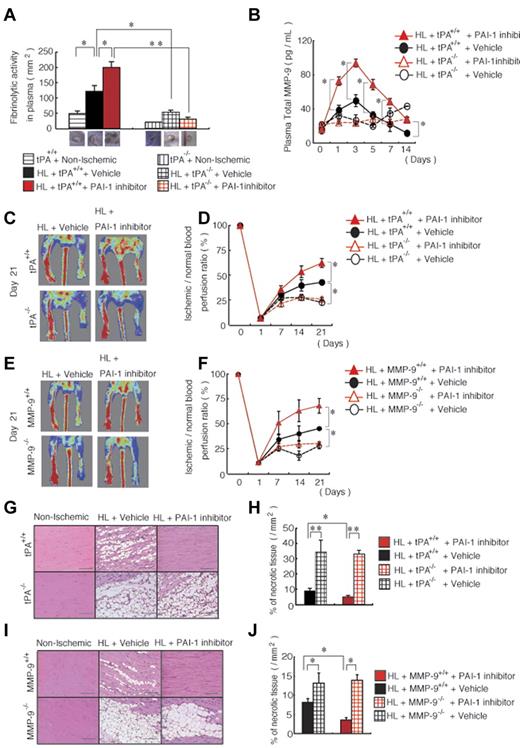 Figure 2. Improved ischemic tissue regeneration after PAI-1 inhibitor treatment depends on tPA and MMP-9. (A-J) HL ischemia was induced in tPA+/+, tPA−/−, MMP-9+/+, and MMP-9−/− mice and the mice were then treated with or without PAI-1 inhibitor daily from days 0-6. (A) Fibrinolytic activity in plasma samples of HL-ischemia–induced tPA+/+ and tPA−/− mice was analyzed on day 1 using a fibrin plate assay (n = 3/group). (B) MMP-9 plasma levels were determined in tPA+/+ and tPA−/− mice treated with the PAI-1 inhibitor or with vehicle by ELISA (n = 9 for tPA+/+ mice; n = 3 for tPA−/− mice). (C,E) Representative images of limb perfusion analyzed using a laser Doppler. (D,F) The limb perfusion ratio (ischemic/nonischemic) over time of tPA+/+ and tPA−/− mice (D) and MMP-9+/+ and MMP-9−/− mice (F) treated with the PAI-1 inhibitor or with vehicle (n = 3/group). (G-J) Necrotic areas in sections of H&E-stained muscle sections (G,I) from untreated and PAI-1 inhibitor-treated ischemic limbs (scale bars, 200 mm). (H,J) Necrotic areas in ischemic muscle tissue sections were evaluated after 21 days (n = 3/group). Data represent means ± SEM. *P < .05; **P < .01.