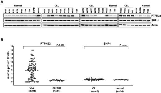 Figure 1. Expression of PTPN22 and SHP-1 in CLL and normal B cells. (A) Cellular extracts from normal PB B cells (PB1, PB2, PB3, PB4, and PB5), normal tonsillar B cells (TB4, TB5, TB6, TB8, and TB9), lymphoma B-cell lines (B104 and BJAB), and CLL B cells were analyzed by immunoblotting with the indicated antibodies. Actin was used as a loading control. (B) Comparison of relative PTPN22 and SHP-1 protein levels in CLL (n = 91 and n = 42, respectively) and normal B cells (n = 14). The BJAB cell line was used as a calibrator. The amount of PTPN22 and SHP-1 in BJAB was arbitrarily set to 1. Mann-Whitney rank-sum test was used to evaluate the significance of differences in PTPN22 and SHP-1 expression between CLL and normal B cells.