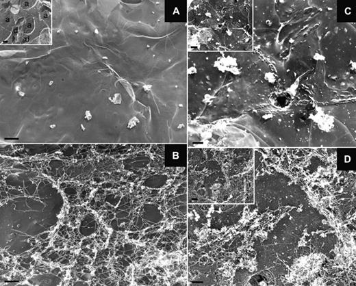 Figure 3. A DNA-based fibrous mesh is present in the lungs of mice with TRALI. (A-D) Representative photographs obtained by transmission electron microscopy of the lung epithelial surface of control mice (A), mice with TRALI (B,D), and mice that were injected with LPS (0.5 mg/kg) and received DNase 1 before anti–H-2Kd mAb injection (C). The fibrous material found in TRALI lungs is absent after DNase 1 treatment. Scale bar represents 1 μm. The insets show low magnification views of the lung surface revealing alveolar sacs (a) and ducts (d); inset scale bars represent 2 μm. The pictures are representative of 3 independent experiments.