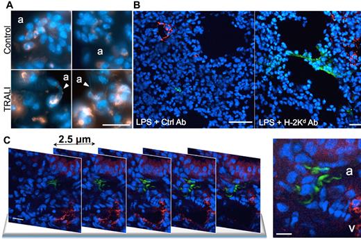 Figure 4. NETs are formed in the lungs of mice with TRALI. (A) Lung tissue cryosections from control healthy mice (control) and from mice with TRALI (2 hours after antibody injection, TRALI) were immunostained for Gr-1 (orange) and stained for DNA (Hoechst 33342, blue) and then observed by widefield fluorescence microscopy. White arrowheads point at NET structures probably originating from Gr-1-positive cells. a indicates alveolus. Scale bar represents 20 μm. (B) Multiphoton fluorescence micrographs of a lung tissue cryosection from an LPS-treated mouse (LPS + Ctrl Ab) and from a mouse with TRALI (LPS + H-2Kd Ab). The sections were immunostained for VWF (red) to show blood vessels, histone H3Cit (green), and counterstained for DNA (Hoechst 33342, blue). Three independent experiments were immunostained. Scale bars represent 200 μm. (C) Multiphoton fluorescence micrographs of lung tissue cryosections from a mouse with TRALI. Five representative sequential sections 2.5 μm apart are shown. Tissue cryosections were stained as in panel B. v indicates vessel. Scale bars represent 10 μm. The z-stack and the 3-dimensional reconstruction of the specimen are online as supplemental Videos 1 and 2.
