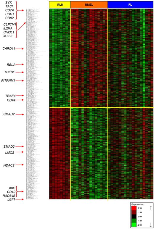 Figure 1. NMZL gene expression signature. Hierarchical clustering of genes with FDR < 0.10 in NMZL versus RLN t test comparison. Some relevant genes of the signature are marked with red arrows. Red and green represent high- and low-level expression, respectively.