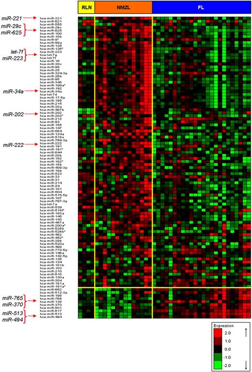 Figure 3. NMZL miRNA signature. Hierarchical clustering of miRNAs with FDR < 0.05 in ANOVA (NMZL vs RLN vs FL) and t test comparison. Some important miRNAs in the signature are marked with red arrows. Red and green represent high- and low-level expression, respectively.