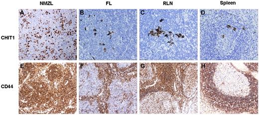 Figure 6. IHC tissue staining. NMZL, FL, and RLN differential expression data revealed by IHC. Examples of cases immunostained for CHIT1 and CD44. All images were acquired using an Olympus A×80 microscope (Olympus) with a magnification 400×, captured with an Olympus DP72 3.0 camera and processed with Cell A software (Olympus Soft Imaging Solutions, Version 3.29).