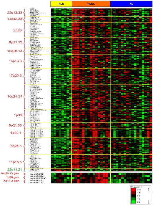 Figure 7. CNA, GEP and miRNA integration data. Hierarchical clustering of signature genes located in the chromosomal bands with copy number aberrations. Red and green represent high- and low-level expression, respectively.