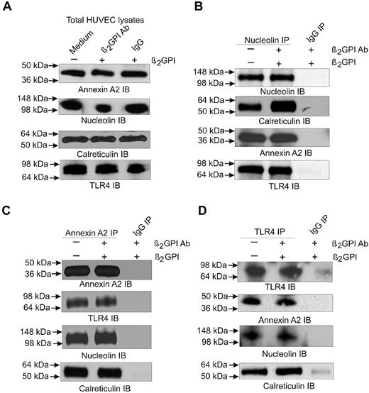 Figure 2. Detection of annexin A2 and TLR4-associated proteins by immunoprecipitation. ECs were either untreated or incubated with β2GPI and anti-β2GPI Abs for 5 hours. Detergent extracts were prepared and analyzed by 4%-12% SDS-PAGE before (A) or after immunoprecipitation using Abs against nucleolin (B), annexin A2 (C), or TLR4 (D). Whole extracts and each of the immunoprecipitates were then immunoblotted using Abs against annexin A2, nucleolin, calreticulin, or TLR4. Extracts were also immunoprecipitated using control IgG, which did not precipitate any detectable protein. The results shown are from 1 representative experiment of 3.