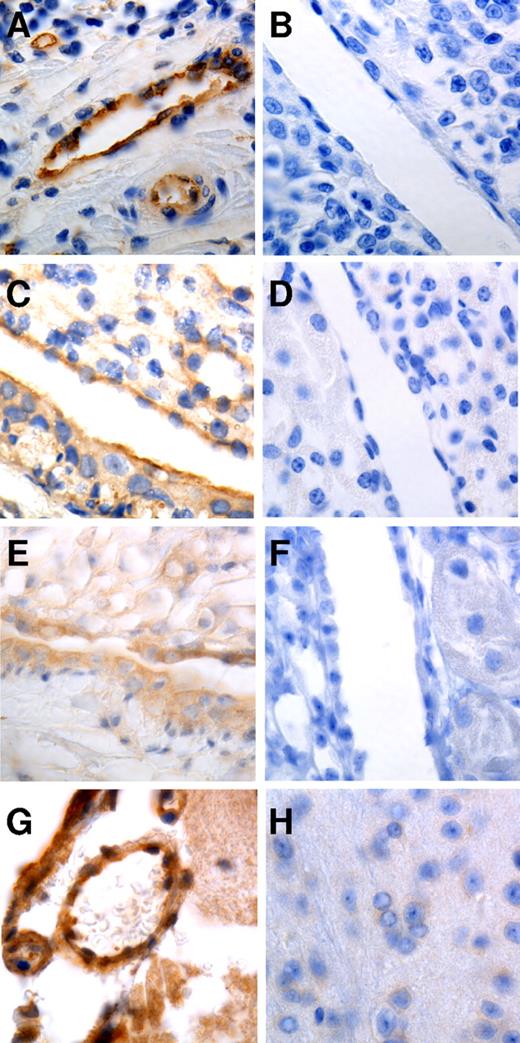 Figure 7. Staining of human and murine tissues for nucleolin and calreticulin. Formalin-fixed, paraffin-embedded tissue was stained with Abs to nucleolin (A,C) calreticulin (E,G), or equal concentrations of control IgG (B,D,F,H). Strong endothelial staining for nucleolin can be observed in human tonsil (A) and mouse kidney (C). Endothelial staining for calreticulin can be observed in mouse kidney (E) and brain (G). Photomicrographs were taken at 63×.