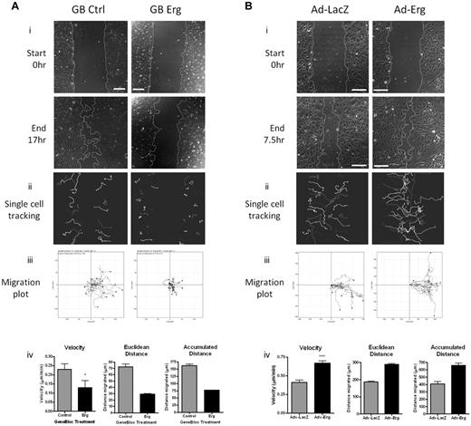 Figure 2. Erg is required for EC migration. (A) HUVECs were transfected with either control-GB FITC or Erg-specific GB FITC for 30 hours. Time-lapse confocal microscopy was used to visualize EC directional migration after a scratch wound. (i) Representative images of scratch wounds at the start and 16 hours after scratching show that compared with control cells (left), directional migration in Erg-deficient cells (right) is reduced. Scale bar, 200 μm. (ii) Single-cell tracking was used to analyze the migratory pathway of individual cells adjacent to the wound. Each track represents the migratory routes of a selected FITC-labeled cell during the course of the 16-hour experiment. (iii) Migration plots showing the migration distance and directionality of single-cell tracks. (iv) Quantification of single-cell velocities, Euclidean distance and accumulated distance were determined from single-cell tracking. Three sets of time-lapse images were captured along each scratch, and 25-40 cells were analyzed per image. *P < .05. Values are mean ± SEM, n = 3 separate experiments. (B) HUVECs were transduced with adenovirus (Ad-LacZ or Ad-Erg) for 48 hours. Endothelial cell directional migration was visualized after a scratch wound by time-lapse confocal microscopy. (i) Representative images showing scratch wounds at the start and at 7.5 hours post-scratch show that compared with Ad-LacZ control cells (left), migration of Erg-overexpressing cells (Ad-Erg, right) is increased. Scale bar, 200 μm. (ii) Single-cell tracking was used to map the migratory pathway of individual cells adjacent to the wound, as above. (iii) Migration plots showing the migration distance and directionality of single-cell tracks. (iv) Quantification of single-cell velocities, Euclidean distance, and accumulated distance were determined from single-cell tracking. Three sets of time-lapse images were captured along each scratch, and 25-40 cells were analyzed per image. ***P < .001. Values are mean ± SEM, n = 3 separate experiments.