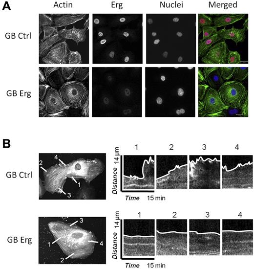 Figure 3. Erg regulates the actin cytoskeleton and lamellipodia dynamics. (A) HUVECs were transfected with control-GB or Erg-specific GB for 40 hours. Cells were trypsinised and replated onto fibronectin-coated glass coverslips for 6 hours before being fixed, labeled and visualized for actin (green), Erg (red), and nuclear marker DAPI (blue). Scale bar, 20 μm. After Erg inhibition, actin stress fibers are redistributed into cortical rings around the cell periphery with loss of stress fibers across the cell body. In addition, Erg-deficient cells exhibit a pronounced angular shape. (B) HUVECs were transfected with actin-RFP and allowed to adhere to fibronectin-coated glass chamber slides for 24 hours before transfection with FITC-conjugated control or Erg-specific GB for an additional 24 hours. GeneBloc-transfected cells were identified by the presence of FITC fluorescence in the nucleus (not shown). In these cells, some actin stress fibers are present across the cell body, probably because of actin overexpression. Actin-RFP dynamics and lamellipodia formation were visualized using time-lapse confocal microscopy with images captured every 15 seconds over a period of 15 minutes. Representative images show dynamics of lamellipodia formation in control (top) and Erg cells (bottom). Kymographs show changes in actin-RFP fluorescence intensity at selected points across the cell membrane. In control cells, dynamic actin-rich lamellipodia and membrane protrusions are observed at multiple points around the cell membrane, while inhibition of Erg results in a dramatic reduction in the formation and collapse of actin-containing lamellipodia and the membrane appears static.