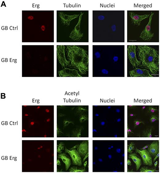 Figure 4. Erg regulates tubulin acetylation. HUVECs grown on gelatin-coated coverslips were transfected with either control-GB or Erg-specific GB for 48 hours. (A) Cells were labeled and visualized for Erg (red), tubulin (green), and nuclear marker TOPRO3 (blue). The microtubule network appears similar in control and Erg-deficient cells. Scale bar, 20 μm. (B) Cells were labeled and visualized for Erg (red), acetylated tubulin (green), and nuclear marker TOPRO3 (blue). Scale bar, 20 μm. In control cells, acetylated tubulin concentrates at the perinuclear region, as expected, whereas in Erg-deficient cells, acetylated tubulin is found throughout the cytoplasm.