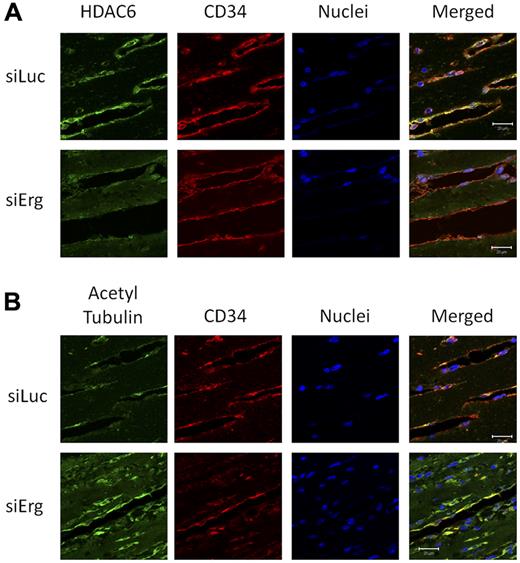 Figure 6. Inhibition of HDAC6 and hyperacetylation of tubulin in vivo by Erg siRNA. Matrigel mixture containing either luciferase control siRNA or Erg-specific siRNA (2μM) with bFGF (80 ng/mL) was injected subcutaneously into C57BL/6 mice. Matrigel plugs were harvested 7 days after implantation, fixed, and sectioned. (A) Sections from Matrigel plugs treated with siRNA for luciferase (top) or Erg (bottom) were stained with Abs to HDAC6 (green), CD34 (red), and with the nuclear marker TOPRO3 (blue) and visualized by immunofluorescence confocal microscopy. Scale bar, 20 μm. HDAC6 staining appears less intense in ECs lining the neovessels in the Erg-siRNA–treated samples compared with the control siRNA sample. (B) Sections from Matrigel plugs containing siRNA for luciferase (top) or Erg (bottom) were stained with Abs to acetylated tubulin (green), CD34 (red), and with the nuclear marker TOPRO3 (blue) and visualized by immunofluorescence confocal microscopy. Scale bar, 20 μm. In Matrigel sections containing Erg siRNA, ECs show an increased acetylated tubulin staining compared with the cells from control siRNA samples.