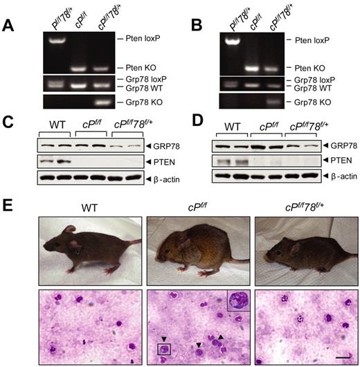 Figure 1. Grp78 heterozygosity impedes PTEN null-induced leukemogenesis. (A-B) Representative PCR genotyping results from WT (Pf/f78f/+), Pten null (cPf/f) and Pten null, Grp78 heterozygous mice (cPf/f78f/+) BM (A) and splenocytes (B) 6 days after completion of pIpC treatment. (C-D) Western blot results for detection of GRP78 and PTEN protein level in the BM (C) and splenocytes (D) performed in duplicates. (E) Top panel: Hunched posture of PTEN null mice compared with normal posture of WT and cPf/f78f/+ mice. Bottom panel: Detection of immature progenitor cells (dark arrows) in the blood smear of PTEN null mice. A magnified image of one of these cells is shown in the upper right corner. Blood smears were mounted with Pro-Texx mounting medium (Lerner Laboratories, #137635). Images were acquired with a Leica Type DMLB2 microscope (63×/1.4 oil objective) fitted with SPOT RT KE SE Model 7.3 Three Shot Color camera and SPOT 4.0.5 computer software (Diagnostic Instruments Inc). Scale bar represents 30 μm.
