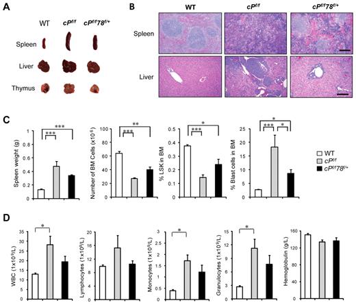 Figure 4. Pten null Grp78 heterozygous mice show MPD characteristics after longer latency period. All analyses were performed 21 days after completion of pIpC treatment. (A) Organ size and morphology from mice of the indicated genotypes. (B) H&E staining of paraffin sections of spleen (top) and liver (bottom) of the indicated genotypes. Scale bar represents 200 μm. Sections of spleen and liver were mounted with Pro-Texx mounting medium (Lerner Laboratories, #137635) and stained with H&E. Images were acquired with a Leica Type DMLB2 microscope (10×/0.3 objective) fitted with SPOT RT KE SE Model 7.3 Three Shot Color camera and SPOT 4.0.5 computer software (Diagnostic Instruments Inc). (C) Quantitation of the spleen weight (n = 6), total BM cell number (n = 6), and percentage of LSK cells in BM (n = 5) and percentage blast cells in BM (n = 6) for each indicated genotype. (D) Complete blood count with tail peripheral blood from WT (n = 7), cPf/f (n = 7), and cPf/f78f/+ (n = 7) mice. Peripheral blood was collected via tail bleeding and analyzed using an auto hematology analyzer BC-2800 vet (Mindray) according to the manufacturer's instructions. Data are mean ± SE. *P < .05 (Student t test). **P < .01 (Student t test). ***P < .001 (Student t test).