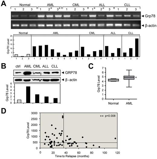 Figure 7. Grp78 expression in leukemia and relapse in childhood ALL. (A) Grp78 mRNA levels measured by RT-PCR from peripheral blood or BM (*) samples of the indicated types of leukemia patients, with β-actin levels as control. Below is a summary of Grp78 transcript level in an expanded study after normalization against β-actin. (B) GRP78 protein expression in Ficoll-Paque isolated peripheral blood mononuclear cells of normal control and leukemia patients (AML, CML, ALL, and CLL). Below is the quantitation of the relative GRP78 level normalized against β-actin. (C) Comparison of Grp78 expression between normal BM (n = 5) and AML patient samples (n = 285) using microarray database. (D) Grp78 expression level determined from microarray database of relapse ALL patients (n = 60) was plotted against time to relapse. The horizontal bar represents median Grp78 expression (456) of all ALL patients; and the vertical bar at the 36-month time point separates patients with early relapse (left) and late relapse (right). *P < .05 (Student t test). **P < .01 (Student t test).