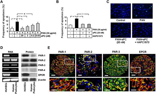 Figure 1. aPC, independent of its anticoagulant property, inhibits apoptosis in human podocytes, which predominantly express PAR-2 and PAR-3. (A-C) aPC reduces dose-dependently and independent of its anticoagulant effect PAN-induced apoptosis in podocytes. Bar graphs summarizing the frequency of apoptosis in PAN-stressed human podocytes treated with different concentrations of aPC (A) or treated with aPC preincubated 1:1 with the antibody HAPC1573, which specifically blocks the anticoagulant properties of aPC (B). Representative images of TUNEL assay with fluorescent-labeled nucleotides (green) and Hoechst 33258 nuclear counterstain (blue, C). (D) PAR-2 and PAR-3 are expressed in human podocytes. Representative images show expression of PARs and EPCR in human podocytes and HUVECs (positive control) as determined by semiquantitative RT-PCR (left panel) and Western blot (right panel). (E) Immunofluorescence images showing strong colocalization (yellow) of PAR-2 and PAR-3, but not of PAR-1 or EPCR (all red) with the podocyte specific marker synaptopodin (green) in normal human kidney samples. PAR-2, conventional fluorescence microscopy on frozen section; PAR-1, PAR-3, and EPCR, confocal microscopy on paraffin sections; Hoechst 33258 nuclear counterstain (blue). Top: Bar represents 50 μm. Bottom: Bar represents 10 μm. Data are mean ± SEM of at least 3 independent experiments performed in duplicates. *P < .001 vs control. XP < .01 vs control (ANOVA).