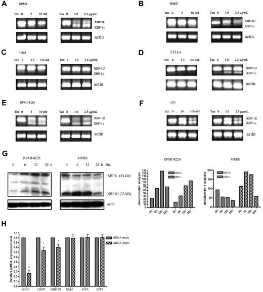 Figure 6. The role of XBP1 in UPR-mediated Mcl-1 expression. (A-F) RT-PCR analysis of XBP1 splicing in different MM cell lines. The MM cell lines OPM2, MMS1, U266, 5T33vt, RPMI-8226, and LP1 were treated with bortezomib and tunicamycin for 24 hours at varying doses. RNA isolation and RT-PCR were performed as described in “Methods.” In the human MM cell lines OPM2, MMS1, U266, RPMI-8226, and LP1, the 210- and 184-bp DNA fragments correspond to unspliced and spliced human XBP1 mRNAs, respectively. In 5T33vt cells, the 343- and 327-bp DNA fragments correspond to unspliced and spliced mouse Xbp1 mRNAs, respectively. (G) Western blot analysis of XBP1 splicing in bortezomib-treated RPMI-8226 and MMS1 cells. Total protein extracts from RPMI-8226 and MMS1 cells treated with 10nM of bortezomib for 0, 6, 12, and 24 hours were electrophoresed and subjected to Western blot analysis using XBP1 Abs. Left panels show the representative blots of 3 independent experiments; right panels show densitometric analysis. (H) qRT-PCR measurement of MCL-1 and UPR-related downstream genes in U266 cells with XBP1 knockdown. n = 3 for all experiments. *P < .05 and **P < .01 versus siRNA mock samples. Data represent the means ± SD.