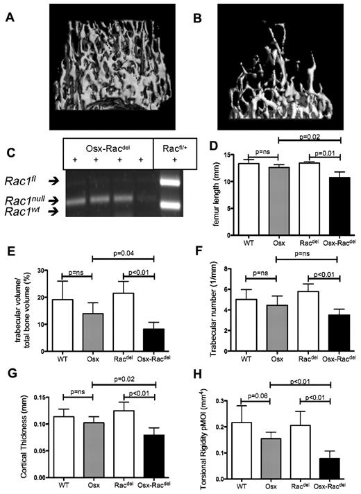 Figure 3. Osteoblast-restricted Rac deletion leads to defective bone acquisition in vivo. Micro-CT images of distal femoral trabecular bone architecture demonstrating normal bone structure in Racdel mice (Cre− controls; A) and marked reduction of trabecular bone volume and abnormal architecture in Osx-Racdel mice (B). (C) Validation of complete excision of Rac alleles in osteoblasts isolated by flow cytometry in OsxRacdel mice but not Osx-WT controls. (D) Bone length was reduced in Osx-Racdel mice (10.7 ± 1.1 mm) compared with Cre− controls (13.4 ± 0.3 mm, P = .01). No difference was observed between Osx and WT controls (12.6 ± 0.5 mm vs 13.3 ± 0.8 mm, respectively, P = .14; n = 3-5 biologic replicates for each genotype). (E) Trabecular bone volume was reduced in Osx-Racdel mice (8.2% ± 2.6%) compared with Cre− controls (21.5% ± 4.4%, P < .01). No difference was observed between Osx and WT controls (13.9% ± 4.1% vs 19.1% ± 6.9%, respectively, P = .15; n = 4-6 biologic replicates for each genotype; F) Trabecular number was reduced in Osx-Racdel mice (3.5 ± 0.6/mm) compared with Cre− controls (5.7 ± 0.8/mm, P < .01). No difference was observed between Osx and WT controls (4.4 ± 0.9/mm vs 5.0 ± 1.0/mm, respectively, P = .15; n = 4-6 biologic replicates for each genotype; G) Cortical bone thickness was reduced in Osx-Racdel mice (0.078 ± 0.014 mm) compared with Cre− controls (0.124 ± 0.016 mm, P < .01). No difference was observed between Osx and WT controls (0.102 ± 0.012 mm vs 0.113 ± 0.014 mm, respectively, P = .18). (n = 4-6 biologic replicates for each genotype; H.) Estimated cortical bone strength (as measured by the polar moment of inertia) was reduced in Osx-Racdel mice compared with Cre− controls (0.08 ± 0.03 mm4 vs 0.20 ± 0.05 mm4, P < .01). A trend to reduced cortical bone strength was observed in Osx transgenic controls compared with WT controls (0.15 ± 0.03 mm4 vs 0.22 ± 0.06 mm4, respectively, P = .06). (n = 4-6 biologic replicates for each genotype.) All values are means ± SD.