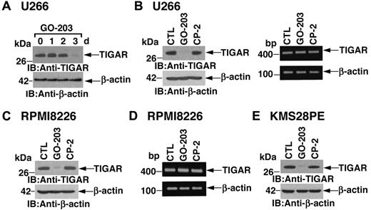 Figure 2. TIGAR protein levels are down-regulated by GO-203 treatment. (A-D) U266 (A,B) and RPMI8226 (C,D) cells were left untreated, and treated with 5μM GO-203 or 5μM CP-2 each day for 3 days. Cells were harvested at the indicated times (A) or on day 3 (B-D). Lysates were immunoblotted with anti-TIGAR and anti–β-actin (A, B left, and C). TIGAR and β-actin mRNAs were amplified by RT-PCR and analyzed by agarose gel electrophoresis (B right and D). (E) KMS28PE cells were left untreated, and treated with 5μM GO-203 or 5μM CP-2 each day for 3 days. Lysates were immunoblotted with the indicated antibodies.