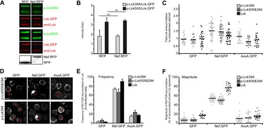 Figure 2. Nef affects intracellular distribution of catalytically active Lck. (A) Western blot analysis of Jurkat T lymphocytes expressing Lck.GFP with RFP or Nef.RFP. All samples were generated within the same experiment and run on the identical gel but are shown as individual boxes to illustrate that lanes in between those shown were removed. Total and active Lck was detected by Abs that recognize all Lck species or are specific for the indicated Lck phospho-species, respectively. (B) LI-COR quantification of the Western blots shown in panel A. Depicted are the ratios of phosphorylated versus total Lck signal intensity. Note that the presence of Nef does not affect abundance of both phosphorylated Lck forms investigated. Values are the arithmetic means of at least 3 independent experiments ± SD (C) Pixel quantification of total or active Lck populations in the presence of the indicated GFP fusion proteins. Jurkat T lymphocytes expressing the indicated proteins were subjected to z-stacks of confocal microscopy, and the total amounts of Lck per cell were determined with ImageJ Version 1.42q software. Values for individual cells are presented with the arithmetic mean indicated by the black line, and are relative to ratios obtained for neighboring untransfected cells that were arbitrarily set to 1. (D) Representative confocal micrographs of Jurkat T lymphocytes expressing the indicated GFP proteins. Shown is the staining for the indicated phosphorylated Lck species. Asterisks indicate GFP-positive cells. Scale bar indicates 10 μm. (E) Numbers of cells that display RE/TGN accumulation of total and active Lck populations. Values are the arithmetic means of at least 3 independent experiments ± SD in which more than 100 cells were counted per condition. (F) Magnitude of Lck RE/TGN targeting per cell. Depicted are the percentages of Lck signal per cell in RE/TGN compartments. Values for individual cells are presented, with the arithmetic mean indicated by the black line.