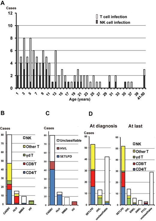 Figure 1. EBV-infected cell phenotypes of EBV+ T/NK lymphoproliferative diseases. (A) Age distribution of patients with T-cell and NK-cell types. (B) EBV-infected cells among categories of clinical groups. Infected T cells were further divided into CD4+ T cells, CD8+ T cells, γδ T cells, and “other T cells.“ The 25 cases of “other T cells” were defined as either phenotypically different T-cell subsets (2 patients were CD4−CD8−, 1 patient was CD4+CD8+, and 1 patient had 2 lineages consisting of CD4+CD8− and CD4−CD8+ cells) or ill-defined T cells (n = 21). In the majority of the ill-defined T-cell patients, Abs against CD4 or CD8 could not be used to define their CD4/CD8 phenotype because the number of recovered PBMCs was not sufficient. SMBA indicates severe mosquito bite allergy; and HV, hydroa vacciniforme. (C) The 4th WHO pathologic classification of each clinical group at the time of diagnosis. SETLPD indicates systemic EBV+ T-cell lymphoproliferative disease of childhood; and HVL, hydroa vacciniforme–like lymphoma. (D) EBV-infected cells among categories of the pathologic classification at diagnosis and at the last follow-up or death. Patients in CR were classified according to the data and status before remission.