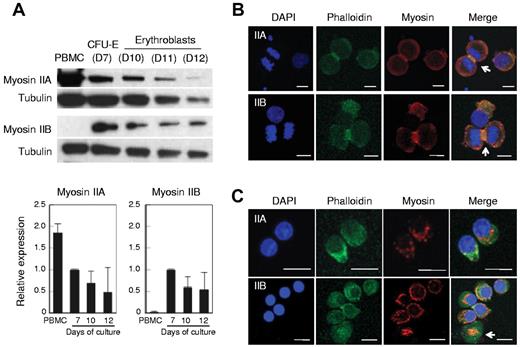 Figure 6. Human erythroblasts express non-muscle myosin IIA and IIB. (A) Western blotting of human PBMCs, CFU-E (day 7 cells, D7) and erythroblasts (D10-D12). D7-D12 indicates days of culture of purified human CD34+ cells to induce erythroid differentiation. At indicated days, the cells were harvested and the protein obtained from 1 × 105 cells was applied to each lane. The relative expression levels of myosin II were normalized with tubulin expression and are the mean ± SD of 3 independent experiments. (B-C) Confocal microscopy of CFU-E (B) and day 12 enucleating mature erythroblasts (C) stained by DAPI, phalloidin and myosin IIA or IIB. NMHC IIA and IIB colocalized with actin (B arrows). In enucleating erythroblasts, NMHC IIB was present on the enucleated reticulocytes in the shape of a small ring colocalized with actin (C arrow).
