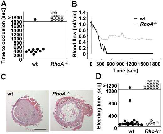 Figure 6. Defective mechanically induced thrombus formation and impaired hemostasis in RhoA−/− mice. (A-C) The abdominal aorta of wt and RhoA−/− mice was injured by tight compression with a forceps, and blood flow was monitored for 30 minutes. Time to stable vessel occlusion (A) and representative blood flow curves (B) are shown. Each symbol represents 1 individual. (C) Representative H&E–stained cross sections of the abdominal aorta of wt and RhoA−/− mice 30 minutes after injury. Scale bar represents 200 μm. (D) Defective hemostasis in RhoA−/− mice. Tail bleeding times of wt and RhoA−/− mice in saline at 37°C. Each symbol represents 1 individual.