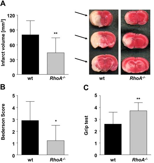 Figure 7. RhoA−/− mice are protected from cerebral ischemia. Formation of cerebral brain infarction and consequential neurologic defects were investigated in a murine stroke model of tMCAO. (A) Brain infarct volumes in wt (n = 24) and RhoA−/− mice (n = 14) presented as mean ± SD (left). Representative images of 3 corresponding coronal sections from wt and RhoA−/− mice stained with 2,3,5-triphenyltetrazolium chloride 24 hours after tMCAO. Infarcted areas are marked with arrows (right). Bederson score (B) and grip test (C) determined 24 hours after tMCAO (*P < .05; **P < .01).