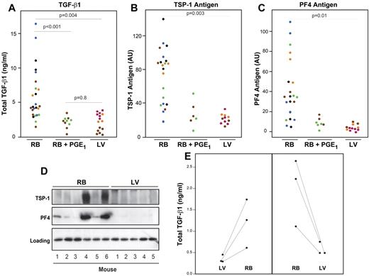Figure 1. The ultrasound-guided LV puncture method of blood drawing minimizes in vitro release of TGF-β1, PF4, and TSP-1 from platelet α-granules into plasma. (A) Blood samples were drawn into sodium citrate anticoagulant by either the RB capillary technique in the absence (RB; n = 25) or presence of 1μM PGE1 (RB + PGE1; n = 10), or by the ultrasound-guided LV method (n = 15). Plasma samples were prepared by centrifuging blood at 3000g for 15 minutes at RT. Total TGF-β1 was measured by ELISA. (B) TSP-1 and (C) PF4 antigen levels were estimated by measuring immunoreactive band intensities on immunoblots. Each dot represents an individual mouse sample, and each color represents data obtained from the same mouse. P values reflect RB values compared with LV values. (D) Representative immunoblots with antibodies to TSP-1 and PF4 of plasma prepared by the RB method from 6 mice and by the LV methods from 5 different mice. Bottom panel: A nonspecific band, indicating that similar amounts of protein were loaded in each lane. (E) Total TGF-β1 was measured in plasma prepared from blood collected first by the LV method and subsequently by the RB method (left panel) or from blood collected in the opposite sequence (right panel).