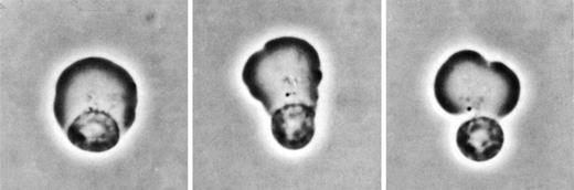 Photomicrographs illustrating the different steps during the enucleation process. The nucleus is first displaced to one side of the erythroblast (left panel). A contractile actin ring is then formed to begin to pinch off the nascent reticulocyte from the nucleus (middle panel). Subsequent redistribution of membrane between the 2 lobes of the dividing cell by vesicle shuttling further restricts the area of contact between the 2 emerging cells (right panel). Images courtesy of Dr Marcel Bessis.