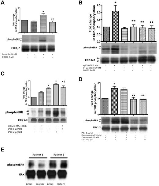 Figure 2. ERK activation in SS RBCs involves the cAMP/PKA pathway and the tyrosine kinase p72syk and is sensitive to the effect of Gαi protein. SS RBCs (A-D), and reticulocyte-enriched and -depleted (mature) SS RBCs (E) were sham-treated, treated with forskolin (A), epi (B-C), PKAI, 14-22 amide, (B), or PTx (C-D) in the presence or absence of the MEKI U0126 (A,B,D), piceatannol (D) or damnacanthal (D). RBC proteins were blotted with antibodies against ERK and phosphoERK. Quantitative analysis of the blots is presented as fold change in ERK phosphorylation. (A-B) ERK undergoes phosphorylation via the cAMP/PKA pathway. (A) ERK undergoes increased phosphorylation after RBC incubation with forskolin, which is inhibited by U0126 (n = 3). *P < .05 compared with untreated cells. **P < .01 compared with forskolin-treated SS RBCs. (B) Phosphorylation of ERK is increased by epi, and this increase was abrogated by either 14-22 amide or U0126 (n = 3). *P < .01 compared with untreated cells. **P < .01 compared with epi-treated SS RBCs. (C) ERK phosphorylation in SS RBCs is enhanced by inactivation of the Gαi protein. PTx at either 1 or 2 μg/mL increased basal ERK phosphorylation (n = 9). *P < .001 compared with nontreated cells; †P < .05 compared with epi-treated SS RBCs. (D) The tyrosine kinase p72syk is implicated in ERK phosphorylation. PTx at 2 μg/mL up-regulated ERK phosphorylation, an effect that was blocked by piceatannol. Conversely, damnacanthal failed to block ERK phosphorylation induced by PTx (n = 3). *P < .01 compared with untreated cells. **P < .01 compared with PTx-treated SS RBCs. (E) ERK1/2 is phosphorylated at baseline in both reticulocyte-enriched and reticulocyte-depleted (mature) SS RBCs (n = 2).