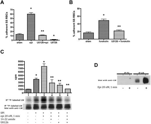Figure 3. ERK signaling modulates both SS RBC adhesion to endothelial cells and ICAM-4 phosphorylation. (A-B) Activation of ERK signaling up-regulates SS RBC adhesion to the endothelium. SS RBCs were sham-treated, stimulated with epi for 1 minute or forskolin, preincubated with U0126 followed by epi or forskolin, or treated with U0126 alone. Adhesion of SS RBCs to HUVECs was tested in intermittent flow condition assays. Results are presented as percent adherent SS RBCs at a shear stress of 2 dynes/cm2. Error bars show SEM of 4 different experiments. (A) *P < .001 compared with sham-treated; **P < .001 compared with epi-treated. (B) *P < .001 compared with sham-treated; **P < .001 compared with forskolin-treated. (C-D) The MEK/ERK signaling cascade is involved in ICAM-4 (LW) serine phosphorylation. (C) Inorganic 32P-radiolabeled intact SS RBCs were incubated in the absence (lane 1) or presence (lanes 2, 3, 4, 5, and 6) of serine/threonine protein phosphatase inhibitors (SPI), followed or not (lanes 1 and 2) by treatment with epi (lanes 3, 4, 5, and 6). In lanes 4, 5, and 6, SS RBCs were preincubated with SPI in presence of PKAI, MEKI, or PKAI + MEKI followed by epi treatment, respectively. The counts per minute (cpm) are representative of 3 different experiments, calculated by subtraction of cpm present in a lane (not shown) containing immunoprecipitates using immunoglobulin P3 from cpm obtained using anti-LW (ICAM-4) mAb for immunoprecipitation under each set of conditions indicated. *P < .05 and *P < .001 for SPI-treated and SPI + epi-treated vs sham-treated, respectively; **P < .001 compared with SPI + epi-treated SS RBCs. Total LW loaded in each lane was detected with the use of nitrocellulose membranes of phosphorylated LW blotted with anti-LW mAb. (D). SS RBCs were incubated without (lanes 1 and 3) or with epi (lanes 2 and 4). Lanes 1 and 2 were immunoprecipitated with P3. Lanes 3 and 4 were immunoprecipitated with anti-LW mAb; all lanes for panel D were immunostained with anti-LW mAb.