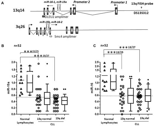 Figure 1. Expression of mir-15a and miR-16 in 13q intact and 13q− CLL. (A) Structure of dleu2-miR-15a-16-1 and smc4-miR-15b-16-2 genes. (B) Levels of miR-15a as measured by quantitative RT-PCR and normalized to the levels of RNU6B used as a loading control in lymphocytes (total and CD19+ B cells) from normal donors and 13q+ or 13q− CLL. The data were then expressed as a percentage of the values obtained for one arbitrarily chosen normal set at 1. Each column on the graph is a composite of dot plots showing the actual expression values of miR-15a and a box and whisker plot representing the 90% confidence interval. Statistical analysis was conducted using ANOVA; mean expression of miR-15a was significantly different between normal lymphocytes compared with 13q normal and 13q− CLL (***P < .001), but was not significant between the 2 groups (13q normal vs 13q−) of CLL. (C) Levels of miR-16 as measured by quantitative RT-PCR and normalized to the levels of RNU6B used as a loading control in lymphocytes (total and CD19+ B cells) from normal donors and 13q+ or 13q− CLL. The data were then expressed as a percentage of the values obtained for one arbitrarily chosen normal set at 1. Each column on the graph is a composite of dot plots showing the actual expression values of miR-6 and a box and whisker plot representing the 90% confidence interval. Statistical analysis was conducted using ANOVA; mean expression of miR-6 was significantly different between normal lymphocytes and 13q normal and 13q− CLL lymphocytes (***P < .001), but was not significant between the 2 groups (13q normal vs 13q−) of CLL.