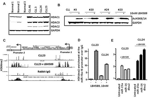 Figure 2. HDAC expression in CLL and consequences of HDAC inhibition on chromatin marks at the miR-15a and miR-16 genes. (A) Expression of HDAC1-3 in CLL and normal lymphocytes. (B) Increased acetylation of histone H3 (H3K9/14) in CLL samples exposed to 10nM LBH589. (C-D) Increased levels of the H3K4me2 modification at the dleu2-miR-15a-16 promoter in CLL samples after exposure to 10nM LBH589 for 5 hours. (E) Induction of miR-15a and miR-16 in the same CLL samples after exposure to 10nM LBH589 for 5 hours.