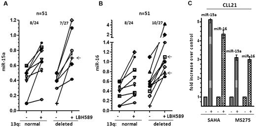 Figure 3. Induction of mir-15a and miR-16 in 13q+ and 13q− CLL on HDAC inhibition. (A) Increase in miR-15a expression in 13q+ and 13q− CLL samples after exposure to 10nM LBH589 for 3-6 hours. The -fold increase after exposure to LBH589 was calculated and then represented as the increase in expression over levels of expression (as determined in Figure 1B) in untreated cells. The arrow (←) marks samples with del13q as the sole abnormality that induced miR-15a. (B) Increase in miR-16 in 13q+ and 13q− CLL samples after exposure to 10nM LBH589. The -fold increase after exposure to LBH589 was calculated and is represented as the change in expression over levels of expression (as determined in Figure 1C) in untreated cells. The arrows (←) mark samples with del13q as the sole abnormality that induced miR-16 (C) Induction of miR-15a and miR-16 in a CLL sample after exposure to the HDAC inhibitors SAHA (3μM) and MS275 (3μM) for 3-6 hours.
