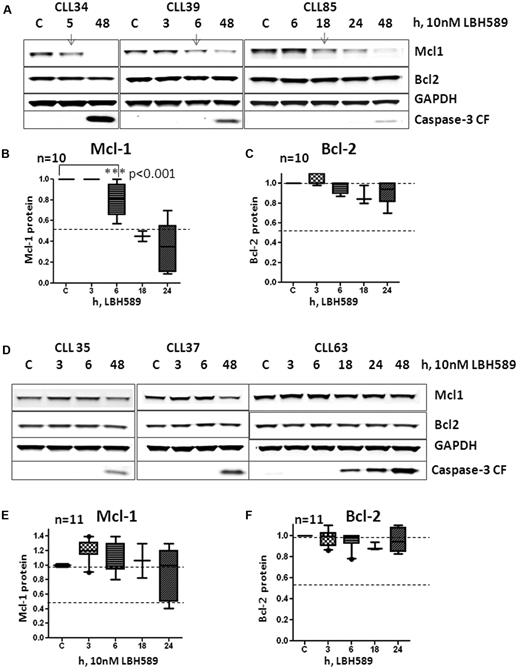 Figure 6. Relation between induction of miR-15a, miR-16, miR-29b, and decrease of Mcl-1 and Bcl-2 in response to 10nM LBH589 in CLL cells. (A) Levels of Mcl-1, Bcl-2, GAPDH, and cleaved caspase-3 at 3, 6, 18, or 24 hours in 3 CLL samples that activated miR-15a, miR-16, or miR-29b in response to 10nM LBH589. (B) Quantitation of Mcl-1 levels at various times (up to 48 hours) in 9 CLL samples that activated miR-15a, miR-16, or miR-29b in response to 10nM LBH589. (C) Quantitation of Bcl-2 levels at various times (up to 48 hours) in 9 CLL samples that activated miR-15a, miR-16, or miR-29b in response to 10nM LBH589. (D) Levels of Mcl-1, Bcl-2, GAPDH, and cleaved caspase-3 at 3, 6, 18, or 24 hours in 3 CLL samples that did not activate miR-15a, miR-16, or miR-29b in response to 10nM LBH589. (E) Quantitation of Mcl-1 levels at various times (up to 48 hours) in 11 CLL samples that did not activate miR-15a, miR-16, or miR-29b in response to 10nM LBH589. (F) Quantitation of Bcl-2 levels at various times (up to 48 hours) in 11 CLL samples that did not activate miR-15a, miR-16, or miR-29b in response to 10nM LBH589.