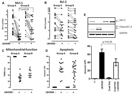 Figure 7. Action of 10nM LBH589 on Mcl-1, Bcl-2, mitochondrial membrane depolarization and apotosis in CLL cells. Change in Mcl-1 (A), Bcl-2 (B), and mitochondrial membrane depolarization as measured by loss of the mitochondrial dye TMRM (C) and increase in annexin V/propidium iodide positivity after exposure to 10nM LBH589 for 48 hours (D). (E) Influence of pre-exposure to z-vad-fmk on the action of 10nM LBH589 for 48 hours on Mcl-1, appearance of cleaved caspase-3, and apoptosis in primary CLL cells (n = 4).