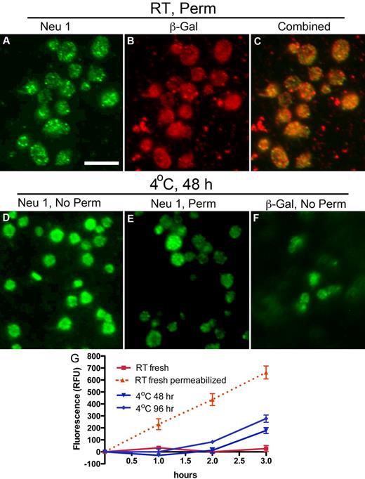 Figure 2. Refrigeration up-regulates glycosidases to the surface of platelets. (A-C) Glycosidase localization in platelets. Immunofluorescence micrographs of fixed and permeabilized resting platelets with the use of anti-sialidase 1 (Neu1) or anti–β-galactosidase (β-Gal) Abs and Alexa-conjugated secondary Abs (green or red). Note the granular pattern of Neu1 and β-Gal staining in the permeabilized platelets (panels A and B, respectively). (C) The combined fluorescence is shown, and some, but not all, of the vesicular structures costain. (D-F) Glycosidase localization in refrigerated platelets. Nonpermeabilized (No Perm) refrigerated (4°C, 48 hours) human platelets were labeled with the anti-Neu1 (D) anti–β-Gal Abs (F). (E) Residual staining for Neu1 in platelets shown by detergent permeabilization (Perm). Scale bar, 5 μm. (G) Sialidase activity associated with fresh (room temperature, RT) or refrigerated human platelets (4°C, 48 or 96 hours). Total sialidase activity in platelets was measured in permeabilized room temperature platelets (n = 3); *P < .05. The amount of 4-methylumbellyferone released in quenched reaction mixtures was measured in 96-well Microfluor-1 Black plates on a Spectra MAX GEMINI EM Microplate Spectrofluorometer (Molecular Devices) with excitation, emission, and cutoff wavelengths of 355, 460, and 455 nm, respectively. Background fluorescence was subtracted from each data point.